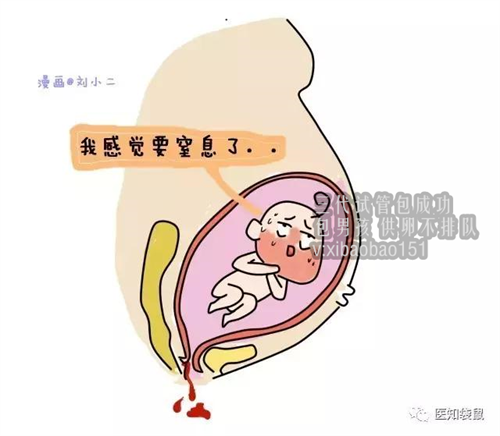 试管代生能决定男女吗,南京找助孕女电话号,早产儿黄疸需要治疗吗
