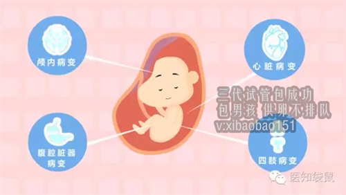 代生孩子选性别多少钱,天津有代孕的嗎,人工授精的孩子寿命多长